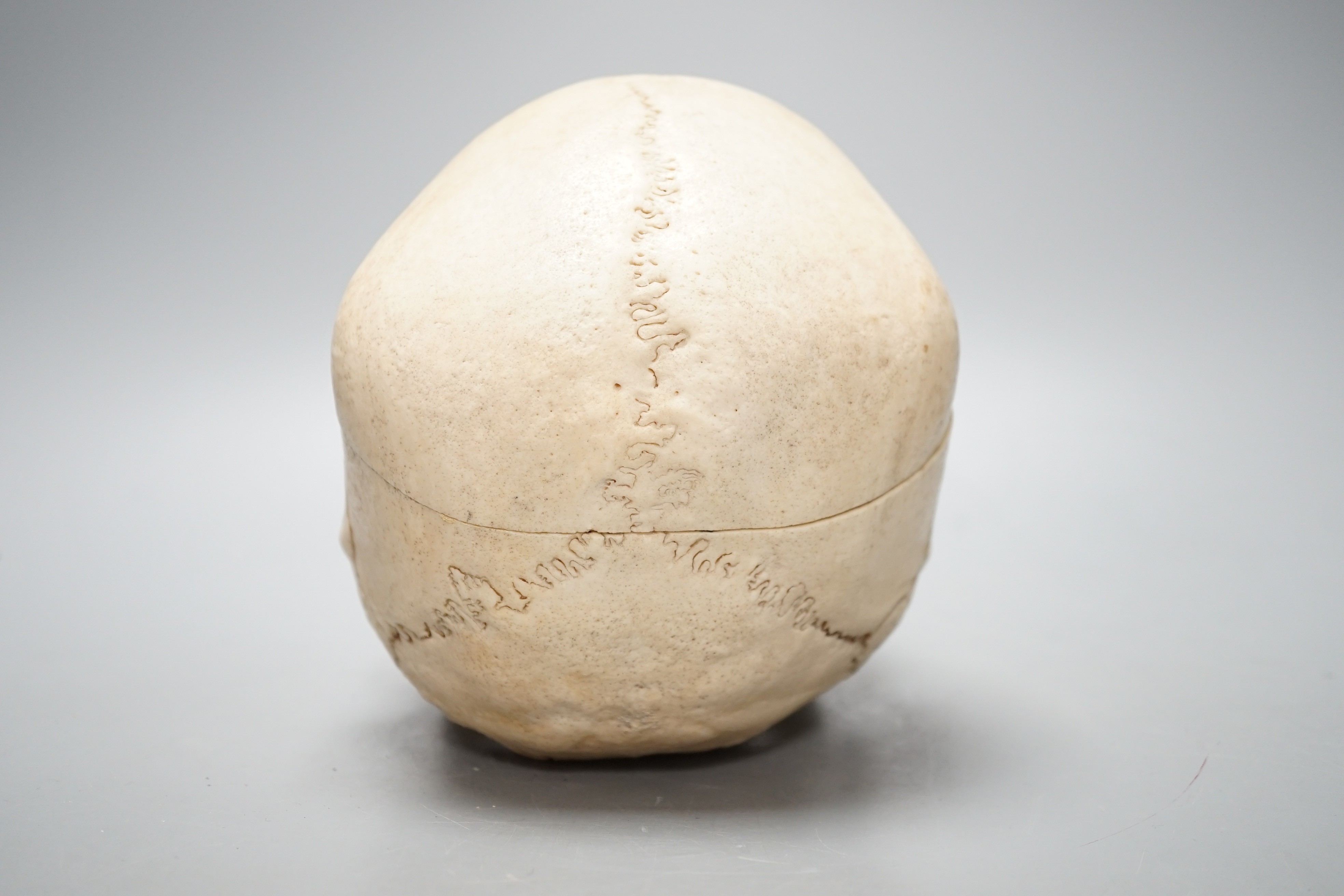 A human skull with removable cranium and spring loaded jaw 15.5cm